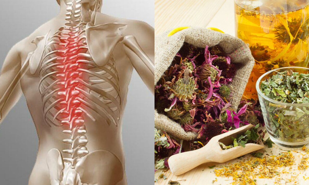 Folk remedies for osteochondrosis of the neck