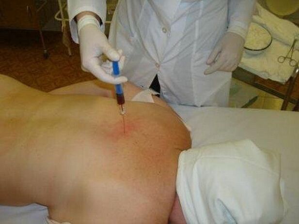 Drugs to Treat Osteochondrosis